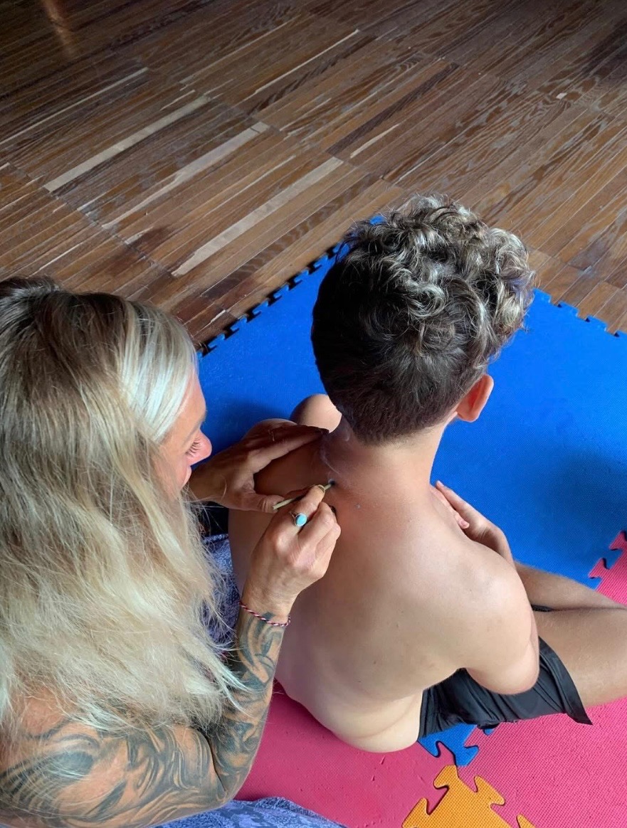 Kambo practitioner applying traditional medicine to participant's shoulder